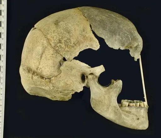 This image provided by National Museum, Prague shows the skull of an ancient human called Zlatý kůň, originally discovered in the Koněprusy caves of the Czech Republic. (Marek Jantač/National Museum, Prague via AP)