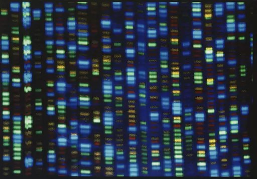 This undated image made available by the National Human Genome Research Institute shows the output from a DNA sequencer. The much-heralded Human Genome Project was a huge milestone for science, but most of that genetic blueprint came from one man from Buffalo, N.Y. On Wednesday, May 10, 2023, scientists announced they have sequenced the genomes of 47 people from around the world, allowing scientists to be able to look at what's normal and what's not across people and learn more about what genes 