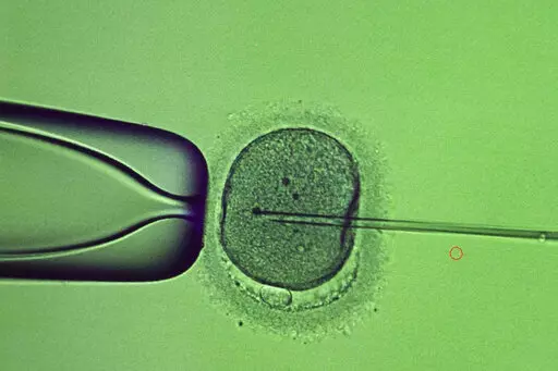 A doctor conducts the procedure of intracytoplasmic sperm injection (ICSI) at the laboratory of the IVMED fertility clinic in Kyiv, Ukraine, Tuesday, Jan. 31, 2023. Some Ukrainian soldiers are turning to the process of freezing sperm as they face the possibility that they might never go home. (AP Photo/Roman Hrytsyna)