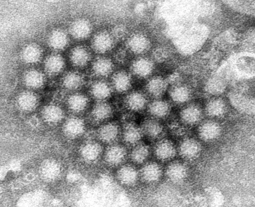 This electron microscope image provided by the Centers for Disease Control and Prevention shows a cluster of norovirus virions. (Charles D. Humphrey/CDC via AP, File)