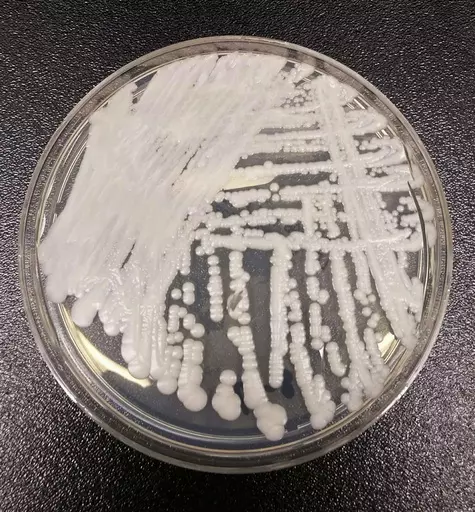 This undated photo made available by the Centers for Disease Control and Prevention shows a strain of Candida auris cultured in a petri dish at a CDC laboratory. In a CDC paper published by the Annals of Internal Medicine on Monday, March 20, 2023, U.S. cases of the dangerous fungus tripled over just three years, and more than half of states have now reported it. (Shawn Lockhart/Centers for Disease Control and Prevention via AP, File)