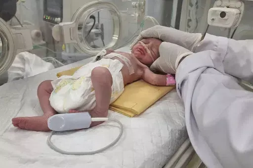 A Palestinian baby girl, Sabreen Jouda, who was delivered prematurely after her mother was killed in an Israeli strike along with her husband and daughter, lies in an incubator in the Emirati hospital in Rafah, southern Gaza Strip. Sunday, April 21, 2024. A premature Palestinian infant, rescued from her mother's womb shortly after the woman was killed in an Israeli airstrike, has died, her uncle said Friday, April 26, 2024. (AP Photo/Mohammad Jahjouh, File)