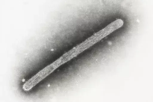 This 2005 electron microscope image shows an avian influenza A H5N1 virion. On Wednesday, May 22, 2024, Michigan health officials said a farmworker has been diagnosed with bird flu, the second human case connected to an outbreak in U.S. dairy cows. (Cynthia Goldsmith, Jackie Katz/CDC via AP)
