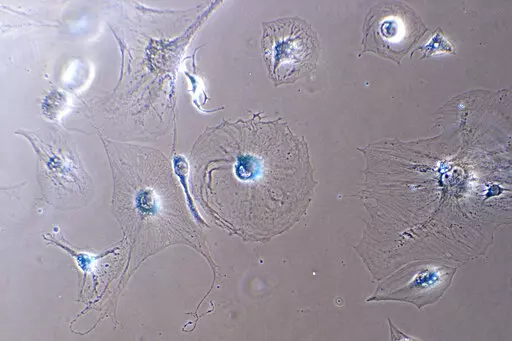 This microscope photo provided by the Mayo Clinic in August 2022 shows senescent myoblast cells. Senescent cells resist apoptosis, or programmed cell death, and characteristically get big and flat, with enlarged nuclei. They release a blend of molecules, some of which can trigger inflammation and harm other cells — and paradoxically also stimulate the growth of malignant cells and fuel cancer, says Mayo Clinic researcher Nathan LeBrasseur. (Dr. Xu Zhang/Mayo Clinic via AP)