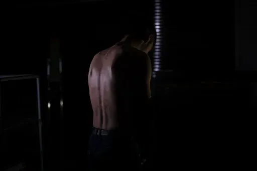 In this Nov. 23, 2022 photo, Igor shows the remains of marks on his back after allegedly being tortured by Russian forces in Kherson. The 22-year-old, accused of providing Ukrainians with Russia's military positions, was stung with a taser along his back for two and half hours and then forced to stay awake, seated in a chair all night. He was freed after two days but not before writing a letter providing details about a relative of his uncle's who the Russians wanted information on. (AP Photo/Be